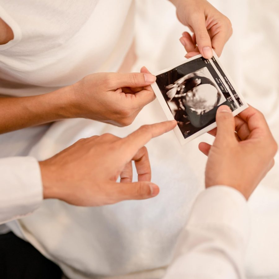 close-up-of-male-doctor-showing-ultrasound-picture-2025-01-10-03-37-12-utc-min